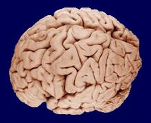 Awareness needs to be created among the relatives of the patients who have been declared as 'brain dead' Hadapsar Latest News