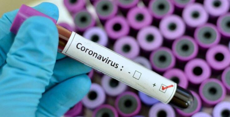 Increase the number of RTPCR tests- Accelerate covid vaccination आरटीपीसीआर चाचण्यांची संख्या वाढवा; कोविड लसीकरणाला पुन्हा गती द्या