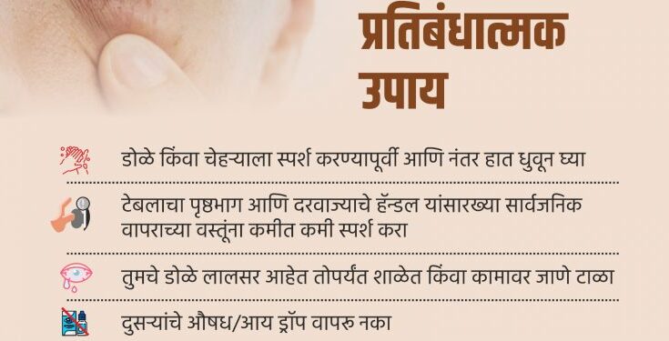 ye infections should be prevented by frequent hand washing डोळे येण्याच्या संसर्गावर वारंवार हात धुण्याच्या सवयीने प्रतिबंध करावा हडपसर क्राइम न्यूज, हडपसर मराठी बातम्या, हडपसर न्युज Hadapsar Crime News, Hadapsar Marathi News, ,Hadapsar News